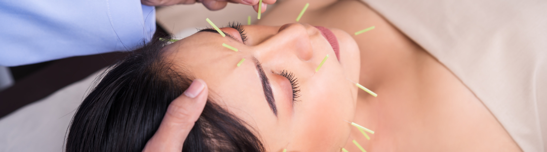 Facial Acupuncture: A Natural Path to Radiant Skin